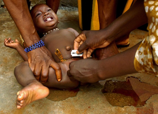 Female-genital-mutilation it is not just boys that these barbaric people mutilate.