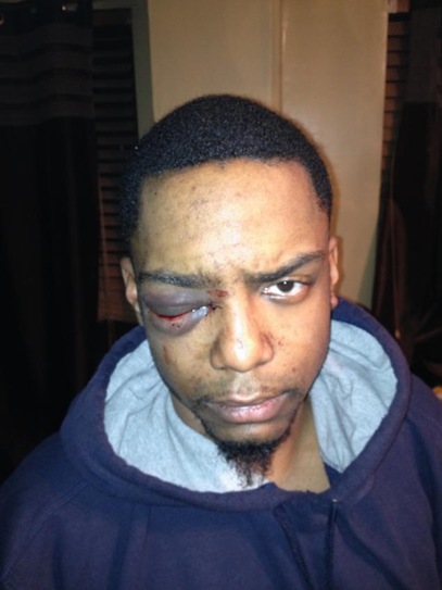 Angry faggot Taj Patterson was beat up by a group of Orthodox Hasidic Jews.