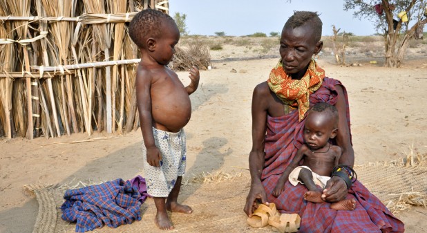 HORNOFAFRICADROUGHT Tipen is a year and two months old, he is severely wasted and malnourished, without a mother to offer him breast milk, he only survives on black tea. Tipen's grandmother Eyangan sometimes feeds him on soup from boiled seeds from the palm tree. Without food and proper treatment the lives of children like Tipen are in danger. In the meantime World Vision will put him on therapeutic treatment. SHARE assignment: s110480-1 Africa; digital; color; horizontal.