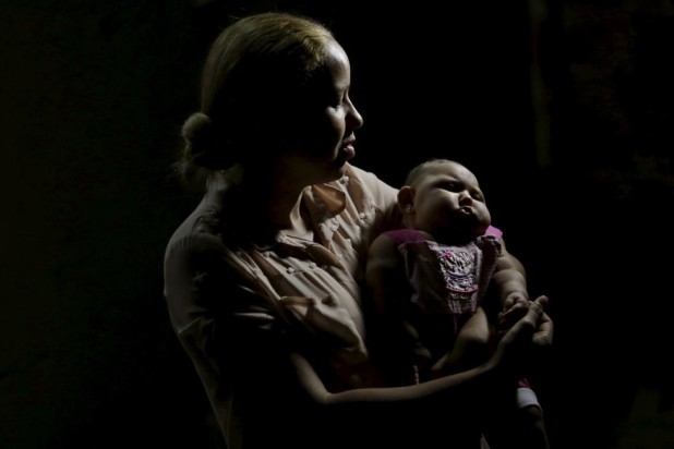 Gleyse Kelly holds her daughter Maria Geovana, who has microcephaly, in Recife, Brazil, January 25, 2016. Health authorities in the Brazilian state at the center of a rapidly spreading Zika outbreak have been overwhelmed by the alarming surge in cases of babies born with microcephaly, a neurological disorder associated with the mosquito-borne virus. REUTERS/Ueslei Marcelino