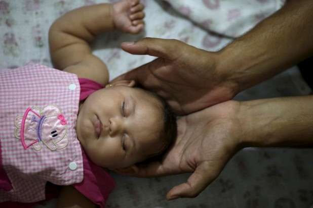 Felipe holds the head of his daughter Maria Geovana, who has microcephaly, at his house in Recife, Brazil, January 25, 2016. Brazil's Health Ministry said in November that Zika was linked to a fetal deformation known as microcephaly, in which infants are born with smaller-than-usual brains. REUTERS/Ueslei Marcelino