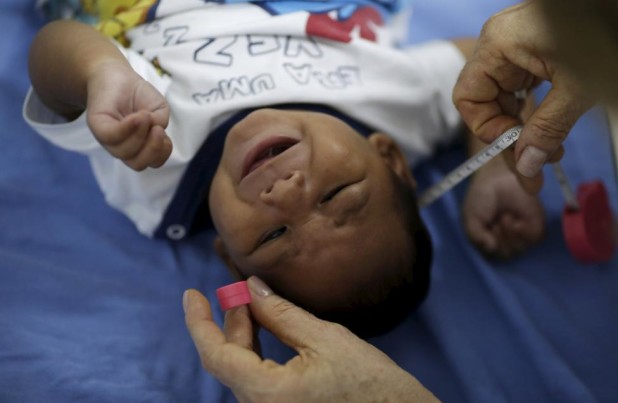 Alessandro Gomes, who has microcephaly, has his head measured by a neurologist at the Oswaldo Cruz Hospital in Recife, Brazil, January 26, 2016. REUTERS/Ueslei Marcelino