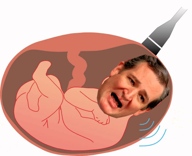 ted cruz sachs fetus