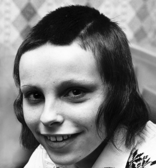 Girl with skinhead haircut, Manchester, 1971.