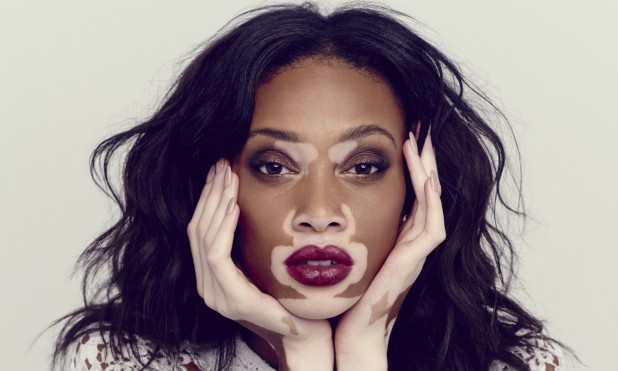 Winnie-Harlow-Race