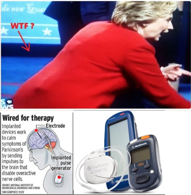 hillary-device-4