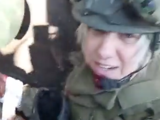 Tranny Freakshow Mascot of the Anal Occupation of Donbass Claims Its Hand was Blown Off