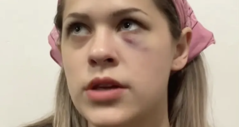 Post Laments “War on Women” After Brute Attacks Rando Woman on the Subway